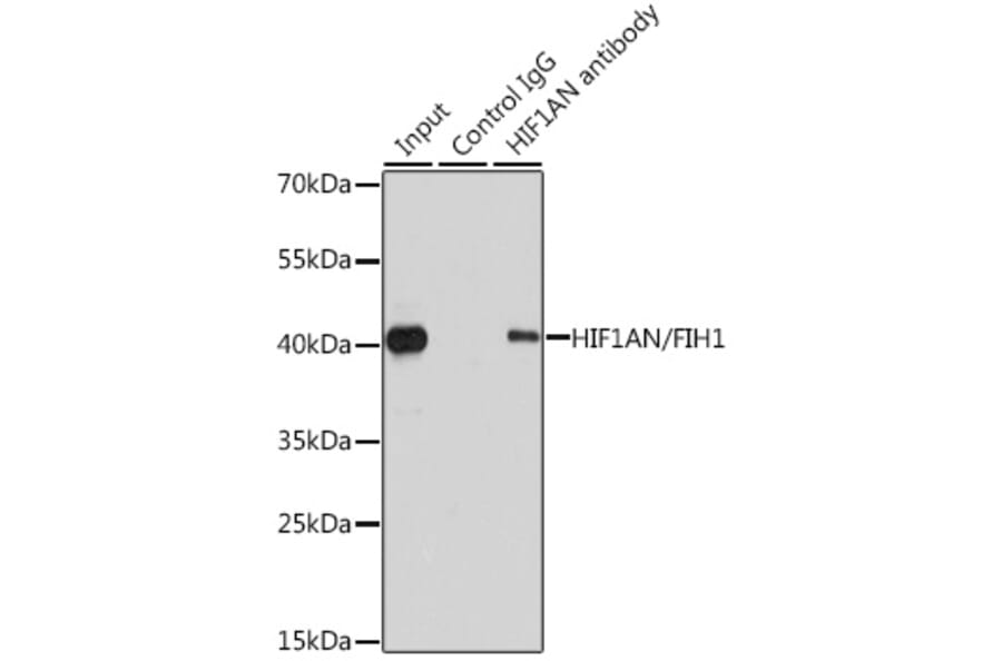 Western Blot - Anti-HIF1AN/FIH-1 Antibody (A14782) - Antibodies.com