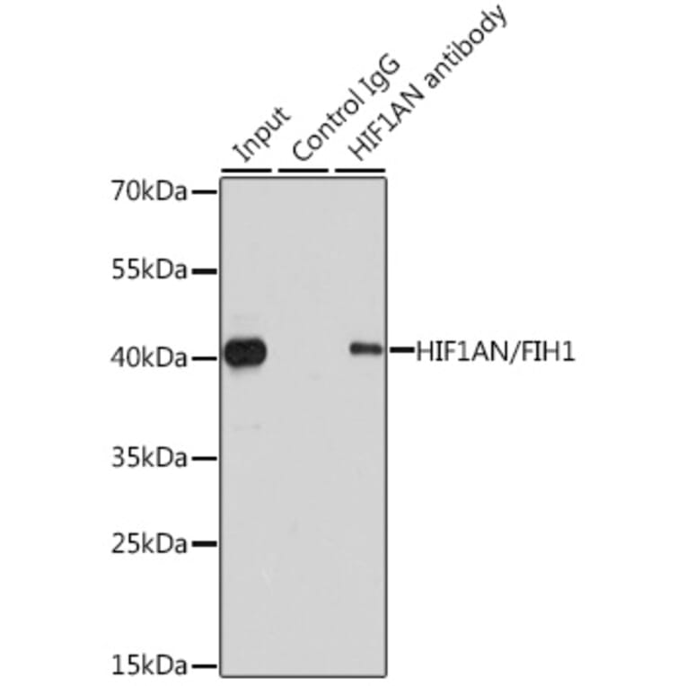 Western Blot - Anti-HIF1AN/FIH-1 Antibody (A14782) - Antibodies.com