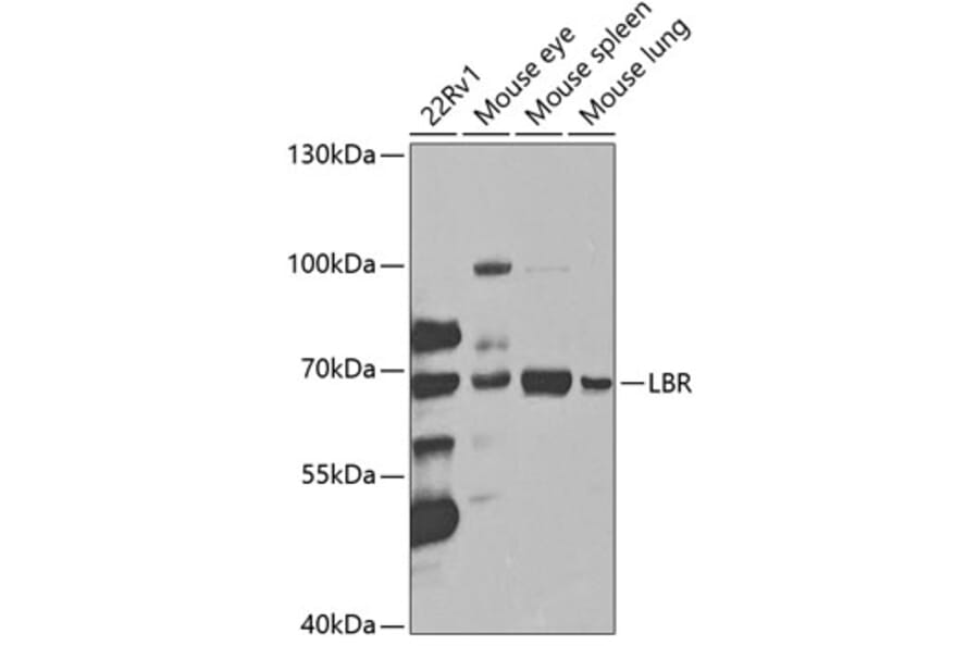 Western Blot - Anti-Lamin B Receptor/LBR Antibody (A14783) - Antibodies.com