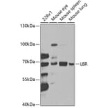 Western Blot - Anti-Lamin B Receptor/LBR Antibody (A14783) - Antibodies.com