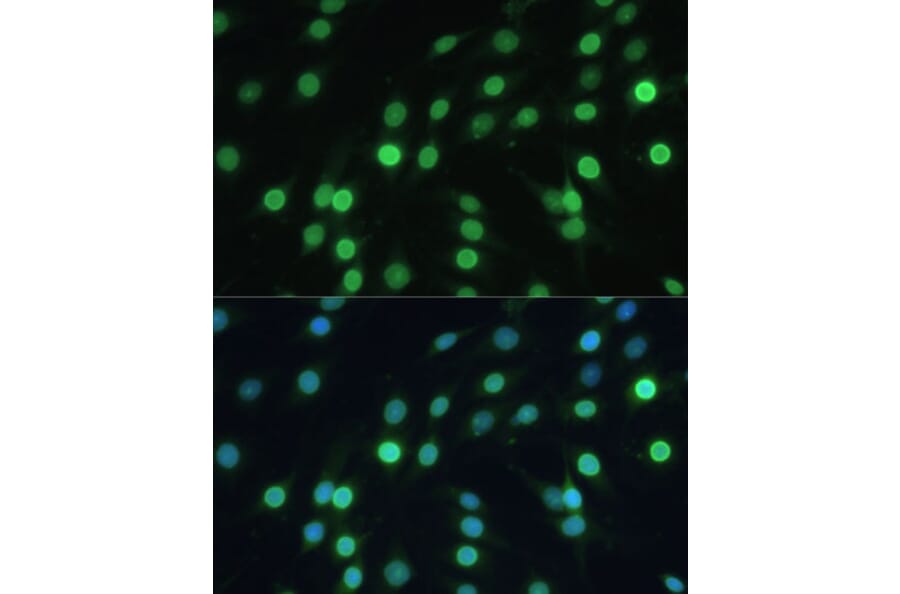 Immunofluorescence - Anti-Lamin B Receptor/LBR Antibody (A14783) - Antibodies.com