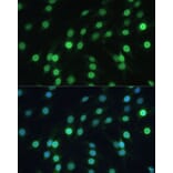 Immunofluorescence - Anti-Lamin B Receptor/LBR Antibody (A14783) - Antibodies.com