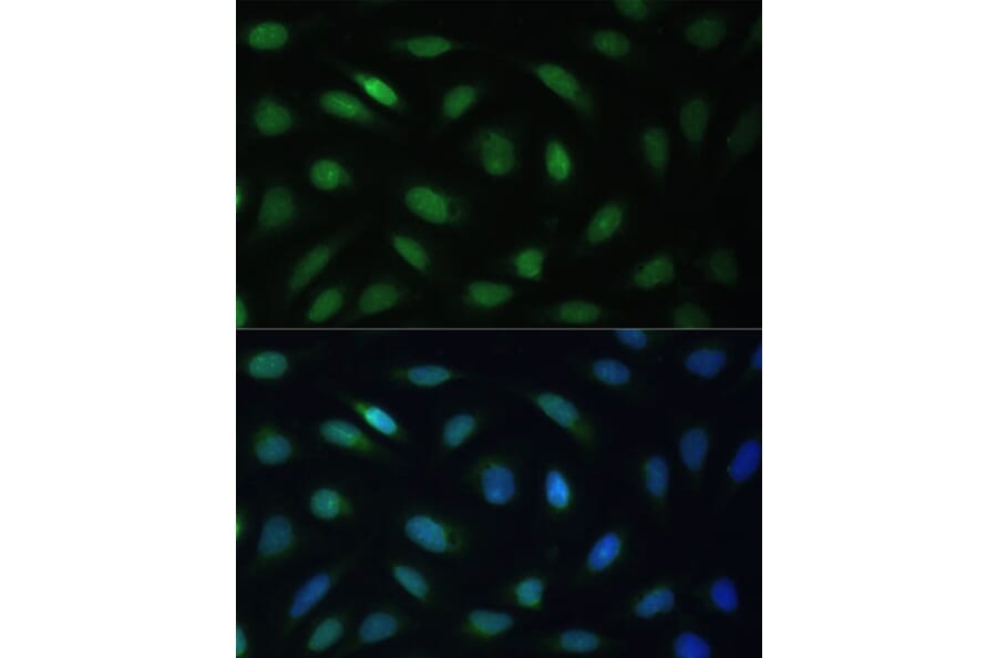 Immunofluorescence - Anti-Lamin B Receptor/LBR Antibody (A14783) - Antibodies.com