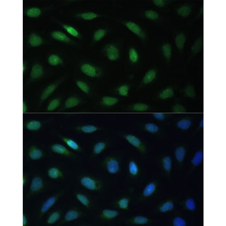 Immunofluorescence - Anti-Lamin B Receptor/LBR Antibody (A14783) - Antibodies.com