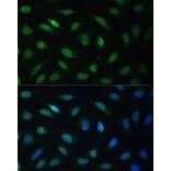 Immunofluorescence - Anti-Lamin B Receptor/LBR Antibody (A14783) - Antibodies.com