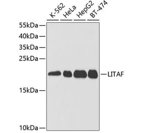 Western Blot - Anti-LITAF Antibody (A14784) - Antibodies.com