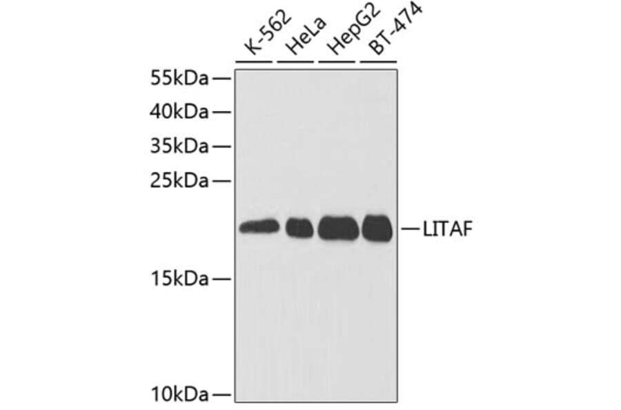 Western Blot - Anti-LITAF Antibody (A14784) - Antibodies.com