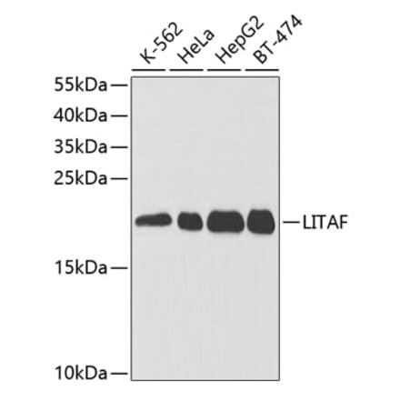Western Blot - Anti-LITAF Antibody (A14784) - Antibodies.com