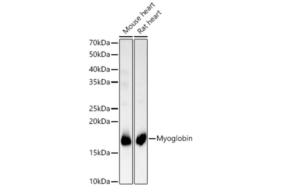 Western Blot - Anti-Myoglobin Antibody (A14785) - Antibodies.com