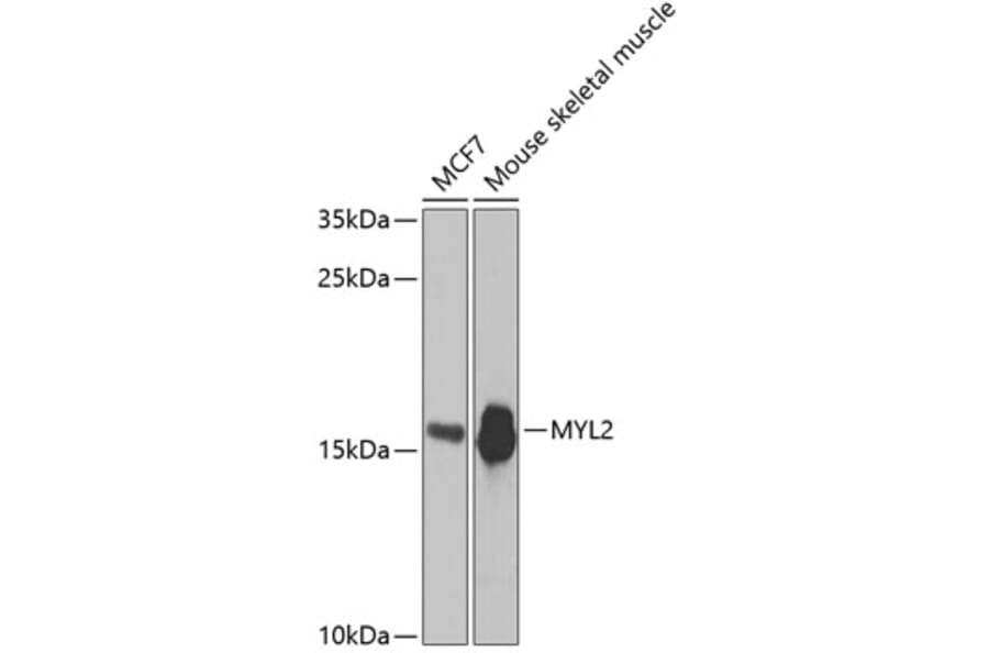 Western Blot - Anti-Myosin Light Chain 2 Antibody (A14786) - Antibodies.com