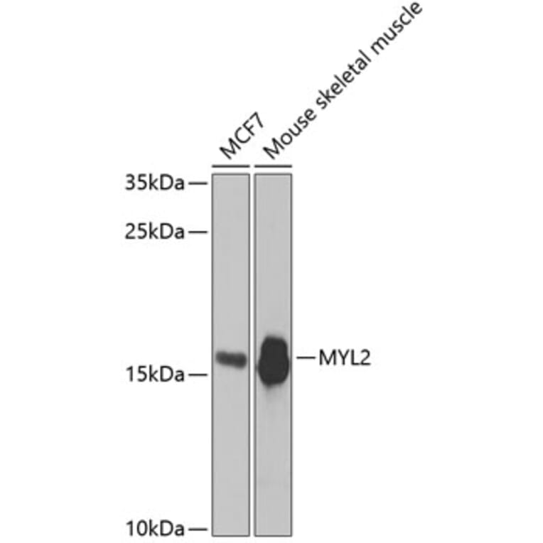 Western Blot - Anti-Myosin Light Chain 2 Antibody (A14786) - Antibodies.com