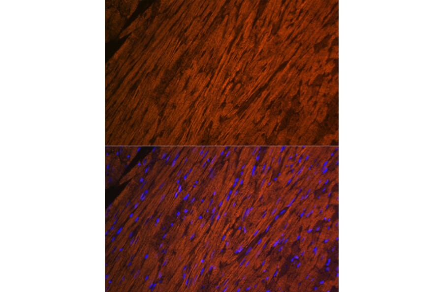 Immunofluorescence - Anti-Myosin Light Chain 2 Antibody (A14786) - Antibodies.com