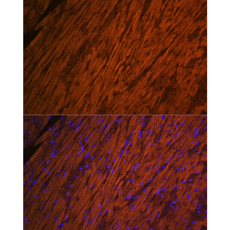 Immunofluorescence - Anti-Myosin Light Chain 2 Antibody (A14786) - Antibodies.com