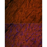 Immunofluorescence - Anti-Myosin Light Chain 2 Antibody (A14786) - Antibodies.com