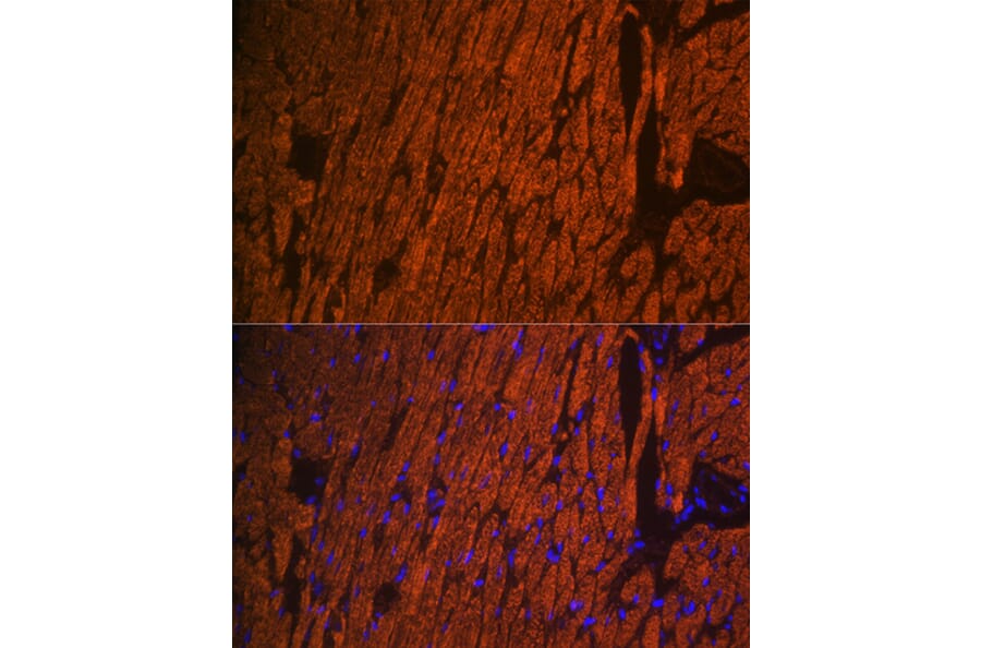 Immunofluorescence - Anti-Myosin Light Chain 2 Antibody (A14786) - Antibodies.com