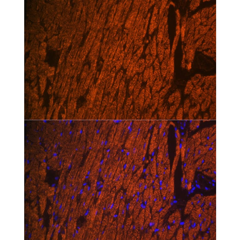 Immunofluorescence - Anti-Myosin Light Chain 2 Antibody (A14786) - Antibodies.com