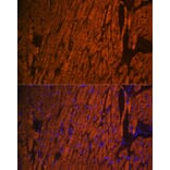 Immunofluorescence - Anti-Myosin Light Chain 2 Antibody (A14786) - Antibodies.com