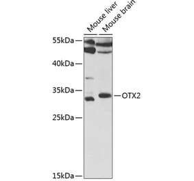 Western Blot - Anti-Otx2 Antibody (A14788) - Antibodies.com