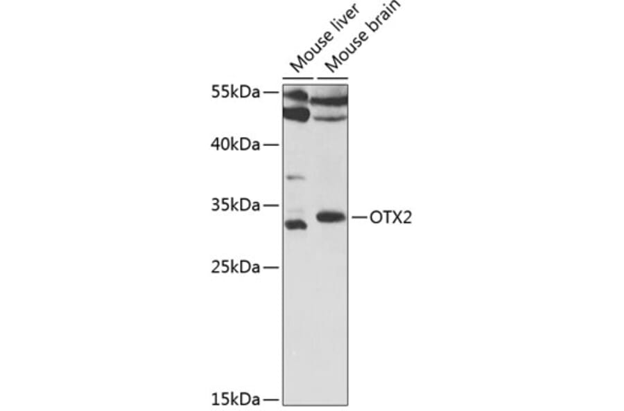 Western Blot - Anti-Otx2 Antibody (A14788) - Antibodies.com