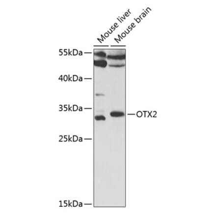 Western Blot - Anti-Otx2 Antibody (A14788) - Antibodies.com