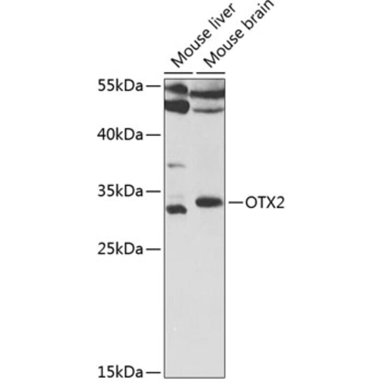 Western Blot - Anti-Otx2 Antibody (A14788) - Antibodies.com
