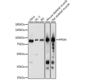 Western Blot - Anti-PFKM Antibody (A14790) - Antibodies.com