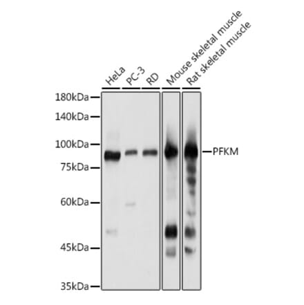 Western Blot - Anti-PFKM Antibody (A14790) - Antibodies.com