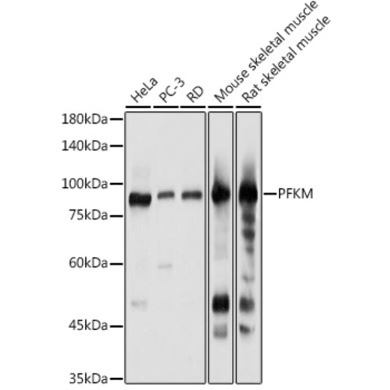 Western Blot - Anti-PFKM Antibody (A14790) - Antibodies.com