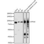 Western Blot - Anti-PFKM Antibody (A14790) - Antibodies.com