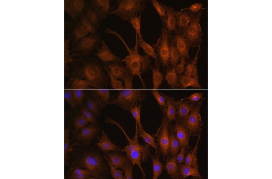 Immunofluorescence - Anti-PFKM Antibody (A14790) - Antibodies.com