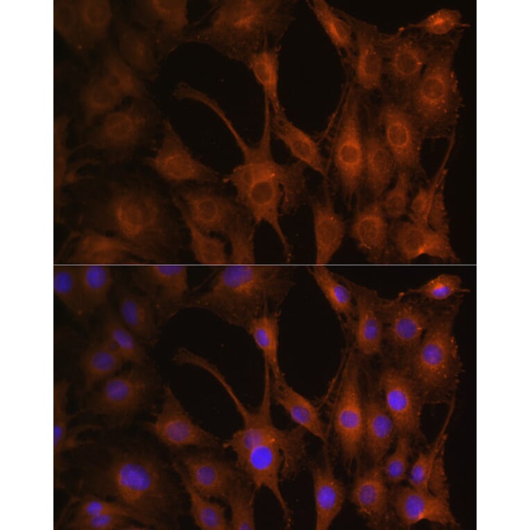 Immunofluorescence - Anti-PFKM Antibody (A14790) - Antibodies.com