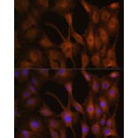 Immunofluorescence - Anti-PFKM Antibody (A14790) - Antibodies.com