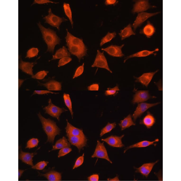 Immunofluorescence - Anti-PFKM Antibody (A14790) - Antibodies.com