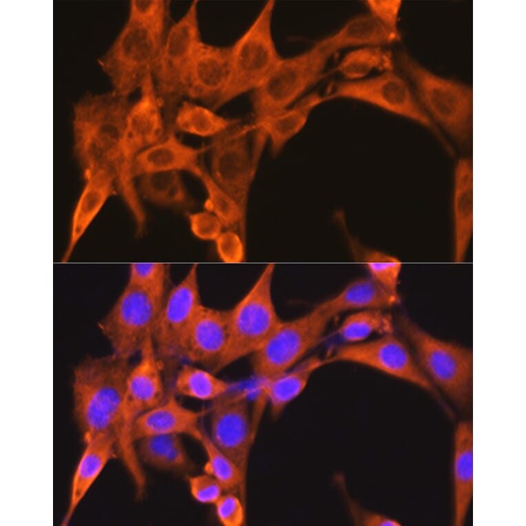 Immunofluorescence - Anti-PFKM Antibody (A14790) - Antibodies.com