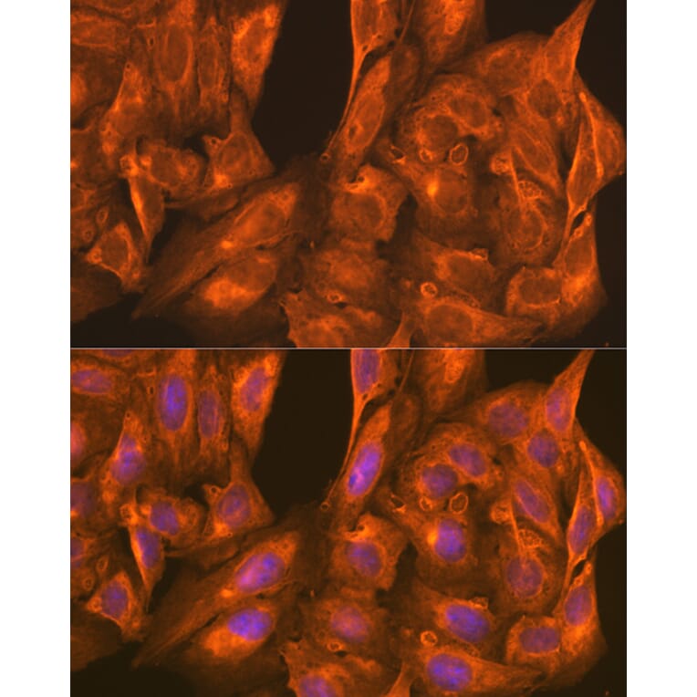 Immunofluorescence - Anti-PFKM Antibody (A14790) - Antibodies.com