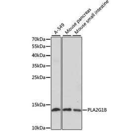 Western Blot - Anti-PLA2G1B Antibody (A14791) - Antibodies.com