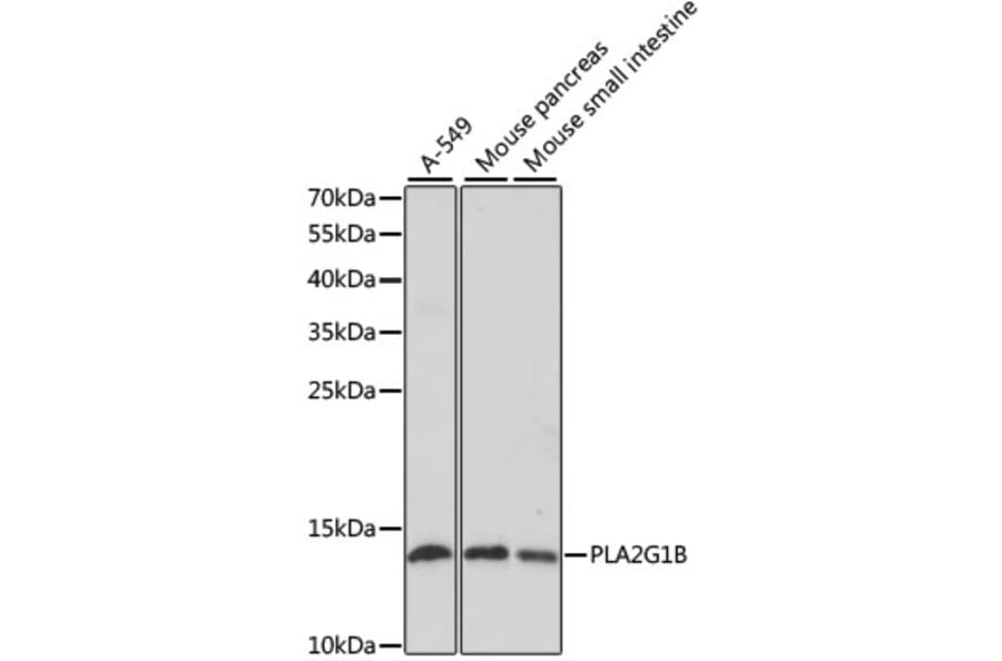 Western Blot - Anti-PLA2G1B Antibody (A14791) - Antibodies.com
