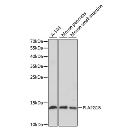Western Blot - Anti-PLA2G1B Antibody (A14791) - Antibodies.com