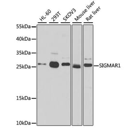 Western Blot - Anti-Sigma1-receptor Antibody (A14792) - Antibodies.com