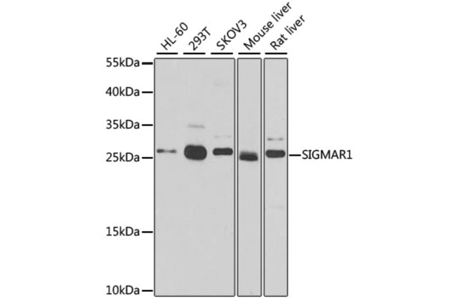 Western Blot - Anti-Sigma1-receptor Antibody (A14792) - Antibodies.com