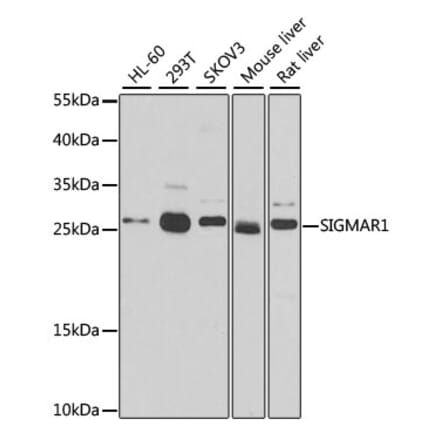Western Blot - Anti-Sigma1-receptor Antibody (A14792) - Antibodies.com