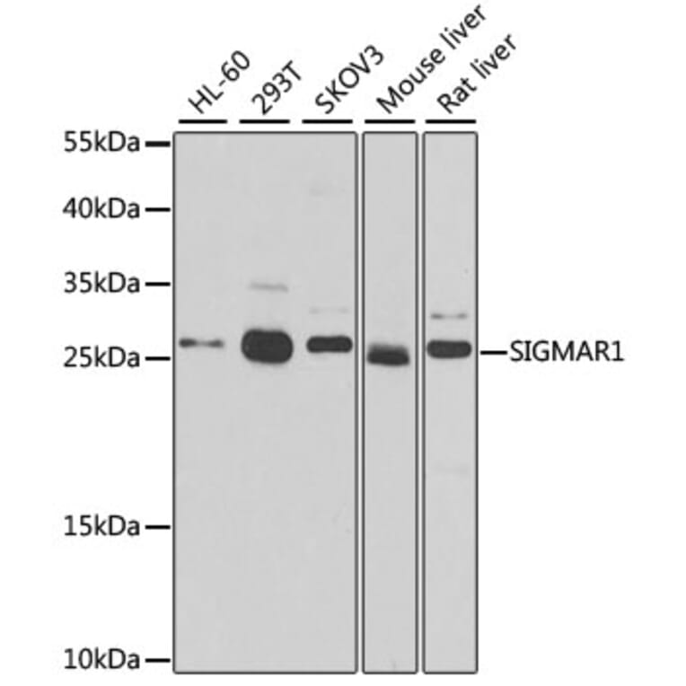 Western Blot - Anti-Sigma1-receptor Antibody (A14792) - Antibodies.com