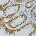 Immunohistochemistry - Anti-Sigma1-receptor Antibody (A14792) - Antibodies.com