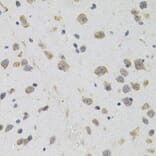 Immunohistochemistry - Anti-Sigma1-receptor Antibody (A14792) - Antibodies.com