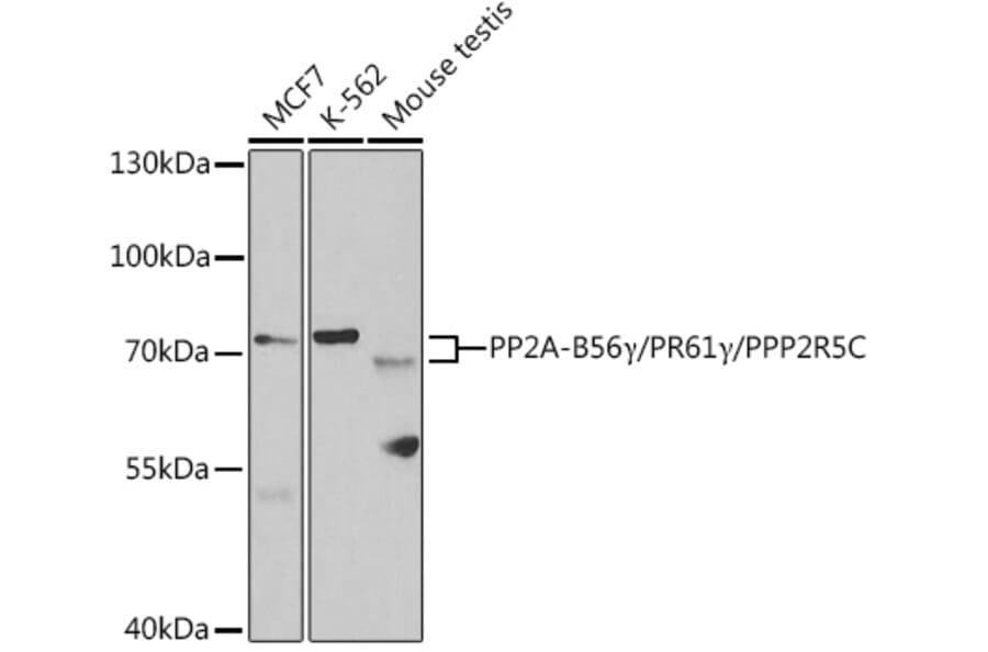 Western Blot - Anti-PPP2R5C Antibody (A14793) - Antibodies.com