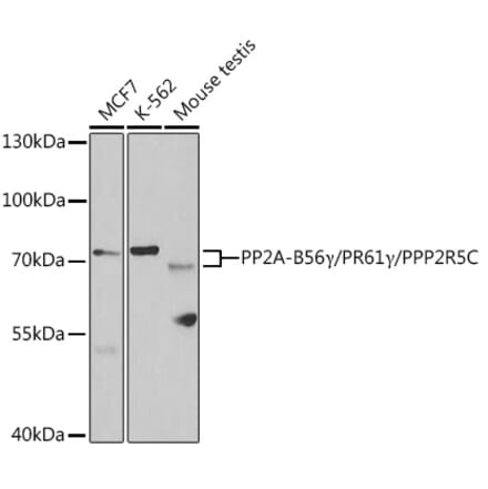 Western Blot - Anti-PPP2R5C Antibody (A14793) - Antibodies.com