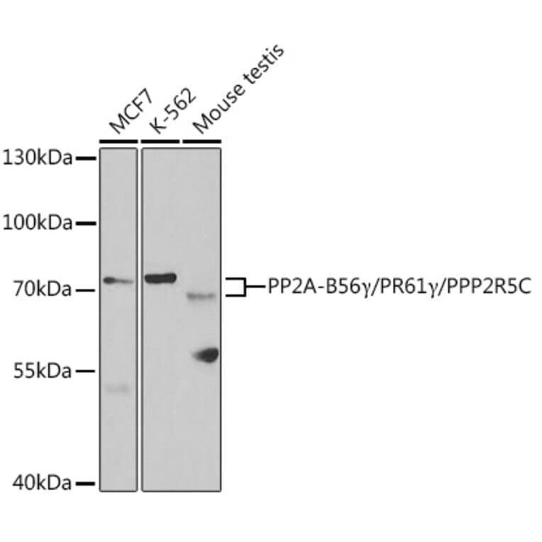 Western Blot - Anti-PPP2R5C Antibody (A14793) - Antibodies.com