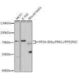 Western Blot - Anti-PPP2R5C Antibody (A14793) - Antibodies.com