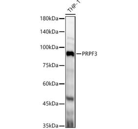Western Blot - Anti-PRPF3 Antibody (A14795) - Antibodies.com