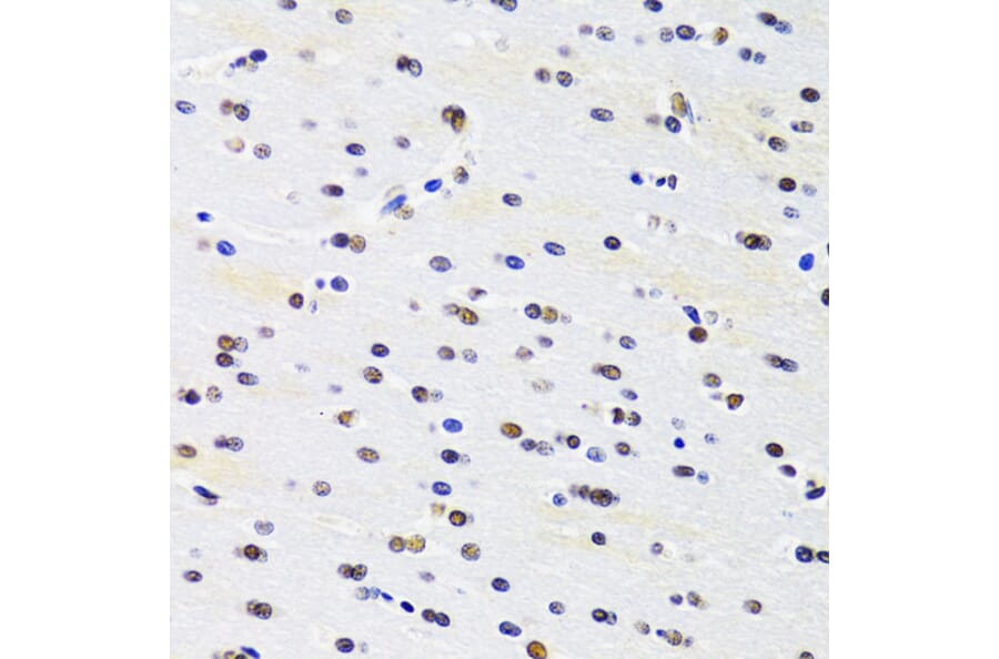 Immunohistochemistry - Anti-PRPF3 Antibody (A14795) - Antibodies.com